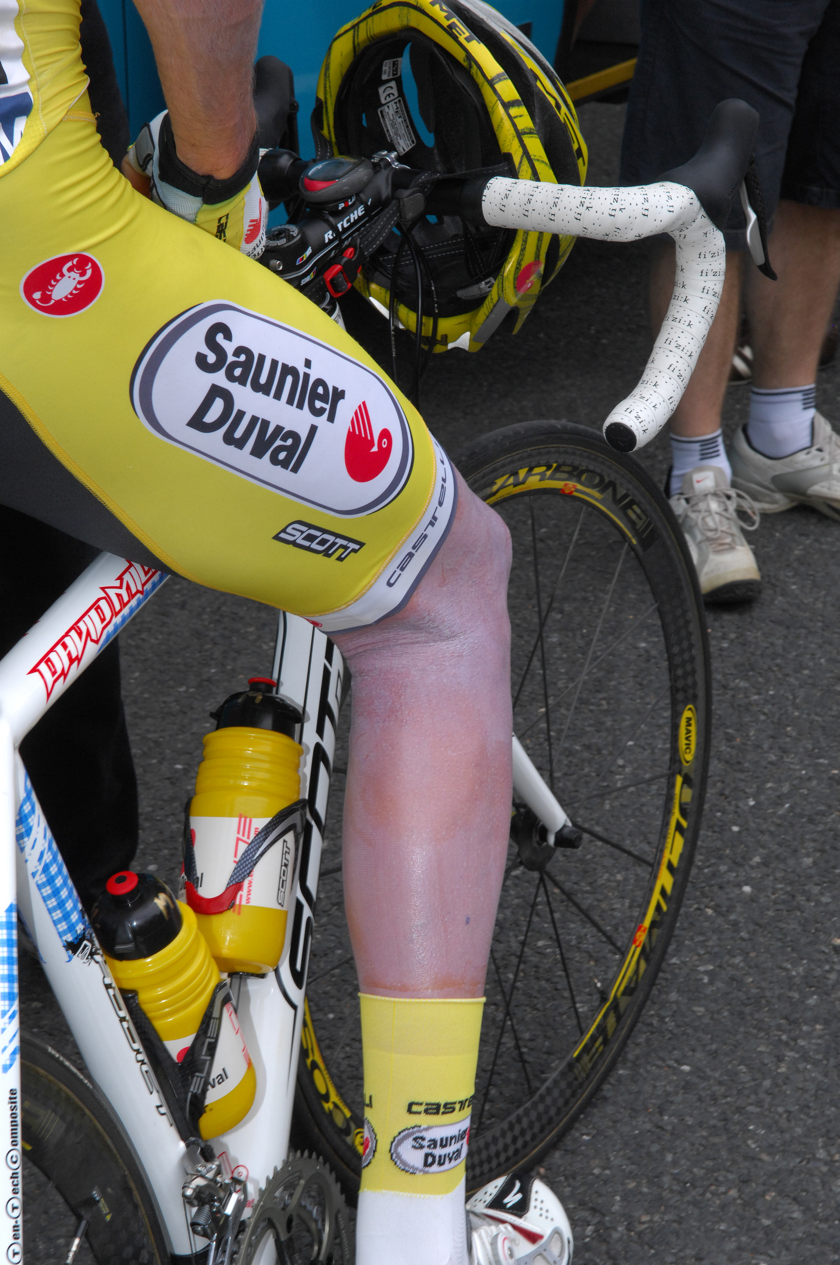 David Millar was still suffering from his skin allergy