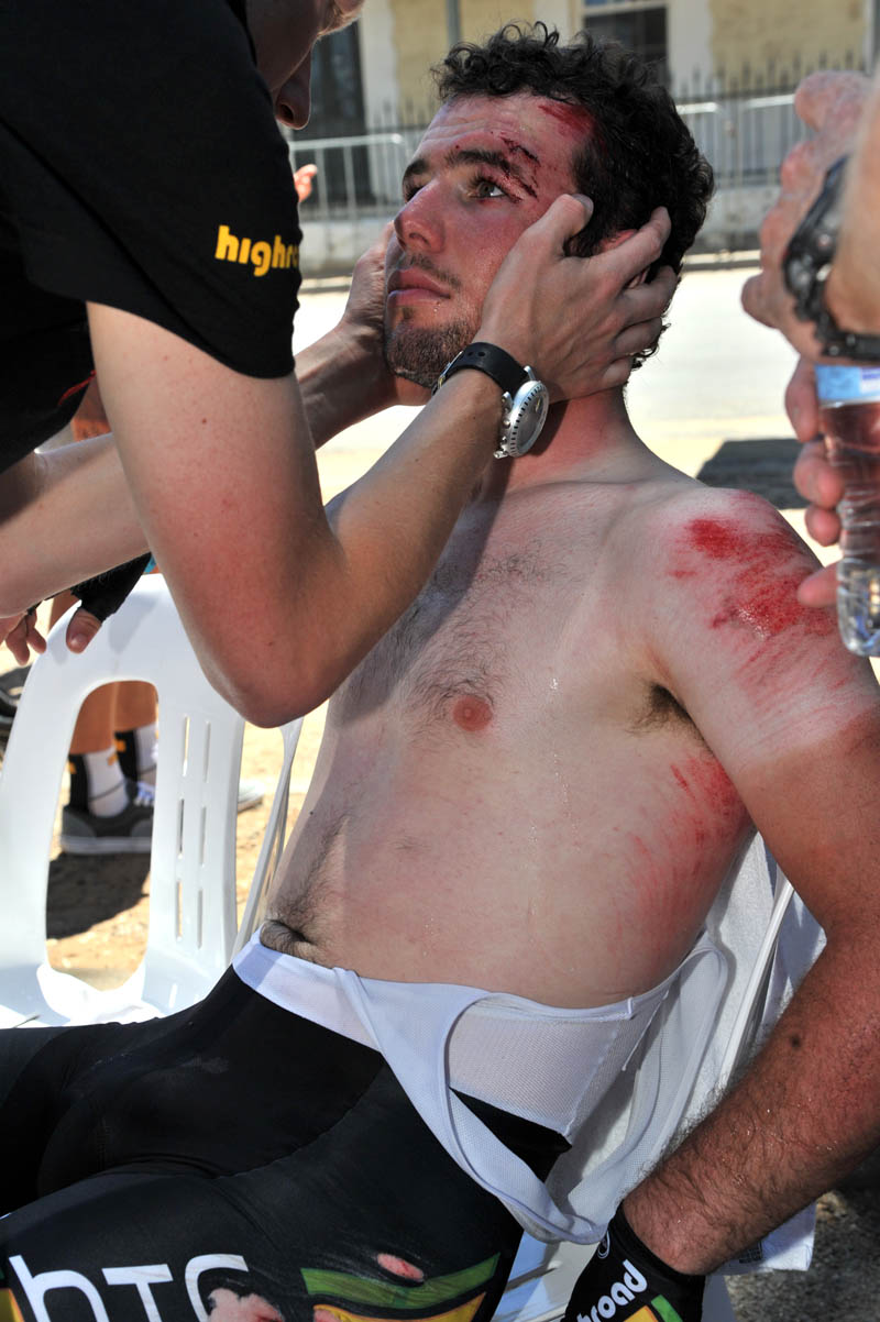 Mark Cavendish's crash injuries, Tour Down Under 2011 stage two