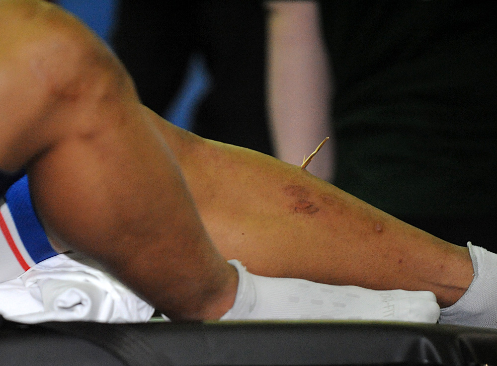 awang, azizulhasni, splinter, track, keirin, crash, track world cup