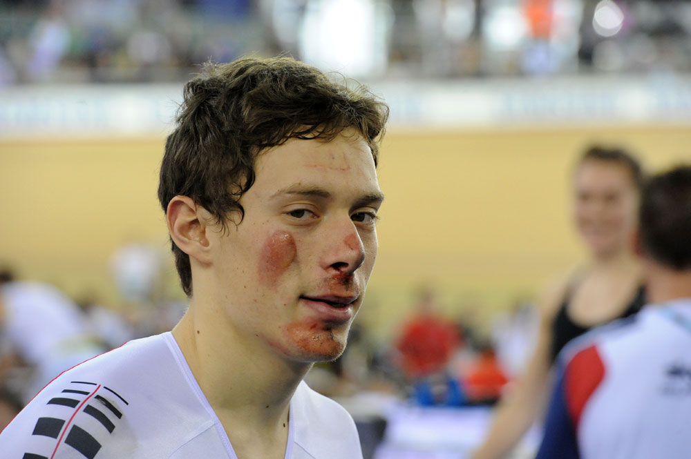 Marks of a crash, London Track World Cup 2012, day two